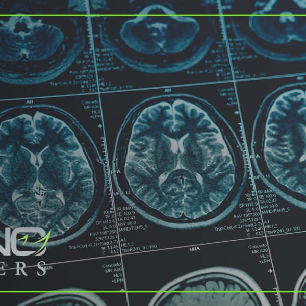 ¿Qué son las lesiones cerebrales por golpe y por contusión?